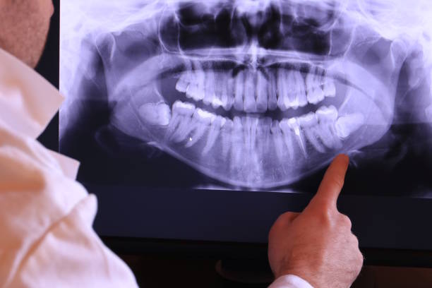 Best Emergency Gum Treatment in Oakland, MD